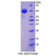 SDS-PAGE analysis of Mouse AST Protein.