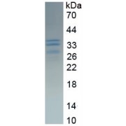 SDS-PAGE analysis of recombinant Human Ataxin 1 Protein.