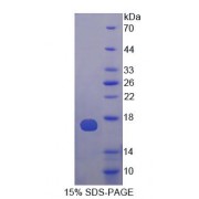 SDS-PAGE analysis of recombinant Human ATPase, H+ / K+ Exchanging Alpha Polypeptide Protein.
