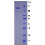 SDS-PAGE analysis of recombinant Human BIRC2 Protein.