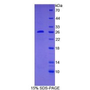 SDS-PAGE analysis of Human BCL2 Protein.