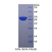 SDS-PAGE analysis of Human B-Cell Linker Protein.