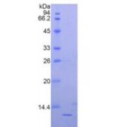 SDS-PAGE analysis of Human beta 2-Microglobulin Protein.