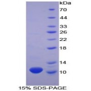 SDS-PAGE analysis of Human beta Thromboglobulin Protein.