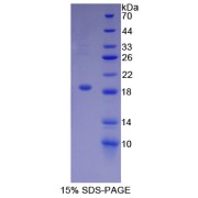 SDS-PAGE analysis of Human Biglycan Protein.