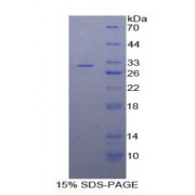 SDS-PAGE analysis of Human CD86 Protein.