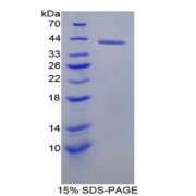 SDS-PAGE analysis of Rat BLC1 Protein.