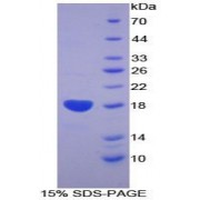 SDS-PAGE analysis of recombinant Human BMPR2 Protein.