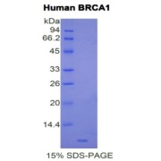 SDS-PAGE analysis of Human BRCA1 Protein.