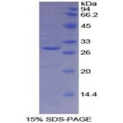 SDS-PAGE analysis of Human BRCA2 Protein.
