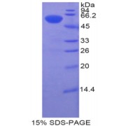 SDS-PAGE analysis of Human Btk Protein.