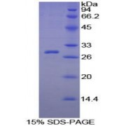 SDS-PAGE analysis of Guinea Pig C-Reactive Protein.