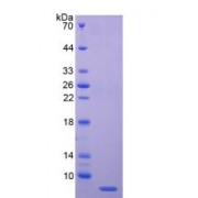 SDS-PAGE analysis of recombinant Human C4b-Binding Protein Alpha Chain (C4BPA) Protein.
