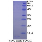SDS-PAGE analysis of Chicken Cadherin, Epithelial Protein.
