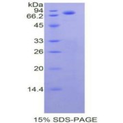 SDS-PAGE analysis of Human Cadherin-1 Protein.