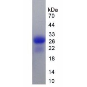SDS-PAGE analysis of Rat Calbindin Protein.