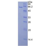 SDS-PAGE analysis of Mouse Calbindin Protein.