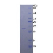 SDS-PAGE analysis of Human Calmodulin Protein.