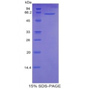 SDS-PAGE analysis of Human Calmodulin 1 Protein.