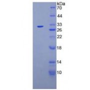 SDS-PAGE analysis of recombinant Mouse CA125 Protein.
