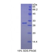 SDS-PAGE analysis of recombinant Human Carbonic Anhydrase II (CA2) Protein.