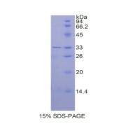 SDS-PAGE analysis of Human Carbonic Anhydrase II Protein.