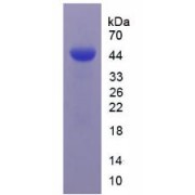 SDS-PAGE analysis of recombinant Human Carbonic Anhydrase IX (CA9) Protein.