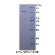 SDS-PAGE analysis of Human Carboxypeptidase E Protein.