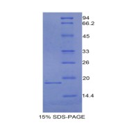 abx065720