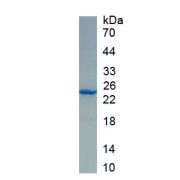 SDS-PAGE analysis of recombinant Human Cardiotrophin 1 (CTF1) Protein.