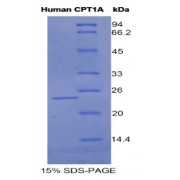 SDS-PAGE analysis of Human CPT1A Protein.