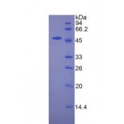 SDS-PAGE analysis of recombinant Mouse CPT1A Protein.