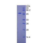 SDS-PAGE analysis of recombinant Mouse CPT1A Protein.