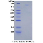 SDS-PAGE analysis of Mouse CILP Protein.