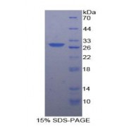 SDS-PAGE analysis of Human CSNK1a1 Protein.