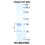 SDS-PAGE analysis of Human Catalase Protein.