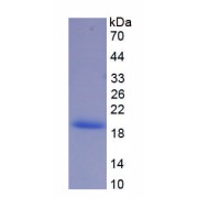 SDS-PAGE analysis of recombinant CAT protein.