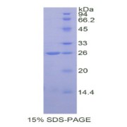 SDS-PAGE analysis of Human COMT Protein.