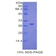 SDS-PAGE analysis of Mouse COMT Protein.