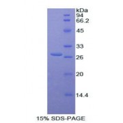 SDS-PAGE analysis of Human Catenin beta 1 Protein.