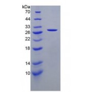SDS-PAGE analysis of recombinant Human Cathepsin K Protein.
