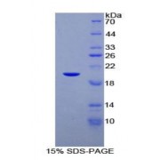 SDS-PAGE analysis of Human C/EBP gamma Protein.