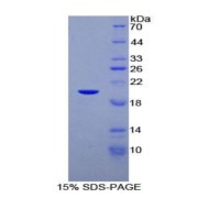 SDS-PAGE analysis of Human C/EBP gamma Protein.