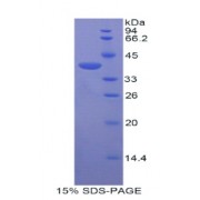 SDS-PAGE analysis of Mouse Centaurin alpha 2 Protein.