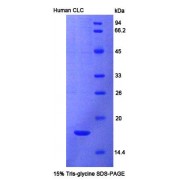 SDS-PAGE analysis of Human CLC Protein.