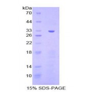 SDS-PAGE analysis of Mouse Checkpoint Homolog Protein.