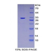 SDS-PAGE analysis of Human Checkpoint Homolog 2 Protein.