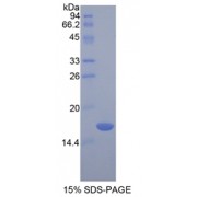 SDS-PAGE analysis of recombinant Rat Chemerin Protein.