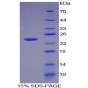 SDS-PAGE analysis of Mouse CXCL15 Protein.
