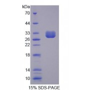 SDS-PAGE analysis of Human CLCA1 Protein.